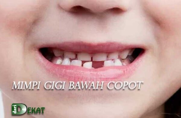 Arti mimpi copot gigi bawah