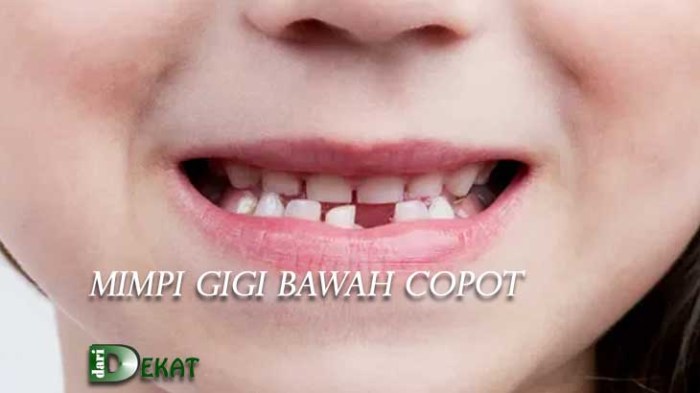 Arti mimpi copot gigi bawah