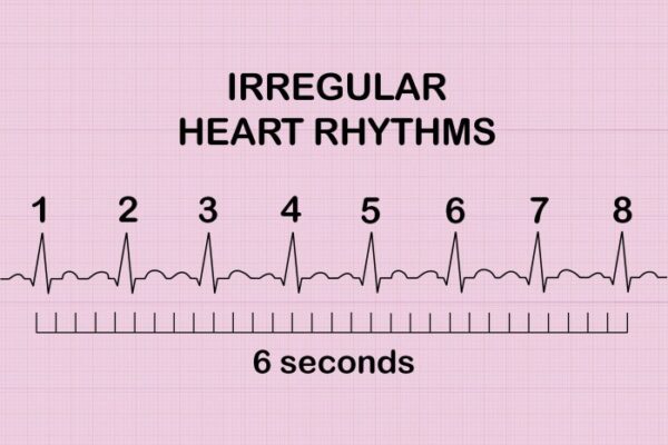 Cara menghitung hr ekg