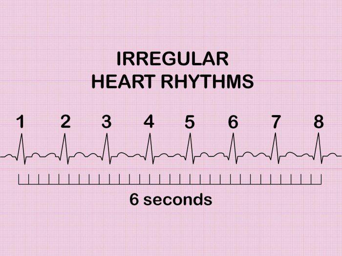 Cara menghitung hr ekg